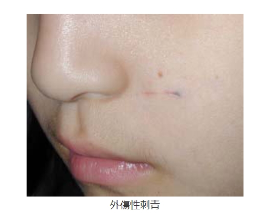 2ta0b0au0rpzvzess5m8f9c75g33i20s.jpg 2ta0b0au0rpzvzess5m8f9c75g33i20s.jpg