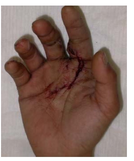 8e5lpm6sqk9e12ms7bny7gqx1ok3pe9p.jpg 8e5lpm6sqk9e12ms7bny7gqx1ok3pe9p.jpg