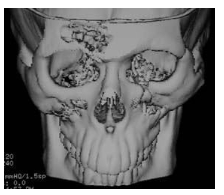 g0p6-4rx9zl-cw3ucq9yygww1ei4gel5.jpg g0p6-4rx9zl-cw3ucq9yygww1ei4gel5.jpg