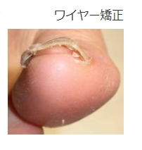 3j_4cvjvnw01t7gjq3jv979u_s_jet8q.jpg 3j_4cvjvnw01t7gjq3jv979u_s_jet8q.jpg