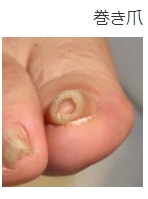 nbubeluhzb27-zkng0uppz4x53dowtl8.jpg nbubeluhzb27-zkng0uppz4x53dowtl8.jpg