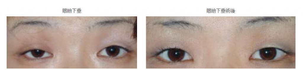 6edtzzm6-uf9_6pl1fx29vw8cy2kflnu.jpg 6edtzzm6-uf9_6pl1fx29vw8cy2kflnu.jpg