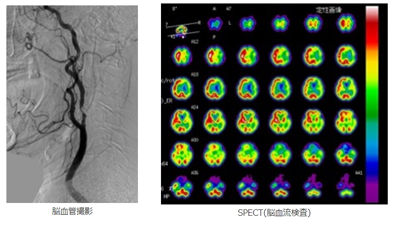 g7-kn0wy6jpyq9bl7bqjr4j7w3grutur.jpg g7-kn0wy6jpyq9bl7bqjr4j7w3grutur.jpg