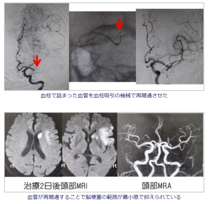 grzbtzvovz4-a21-kagsdmuagrbf4ykq.jpg grzbtzvovz4-a21-kagsdmuagrbf4ykq.jpg