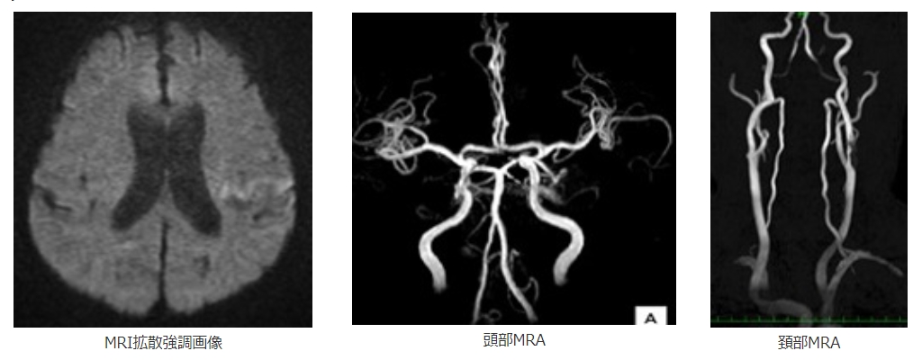 n_zgo_j51ih3imlh5bas77ckpok25s4z.jpg n_zgo_j51ih3imlh5bas77ckpok25s4z.jpg