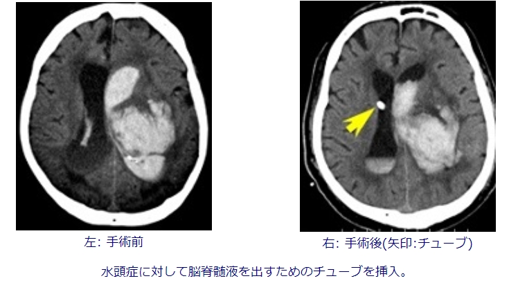 3vhmv31w2a7xhlkgsxphk-08t1zo1tsn.jpg 3vhmv31w2a7xhlkgsxphk-08t1zo1tsn.jpg