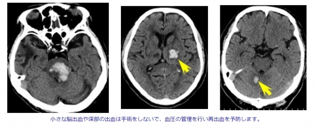 h402o3h95n-g7ia5ief-t9t55n1l24js.jpg h402o3h95n-g7ia5ief-t9t55n1l24js.jpg