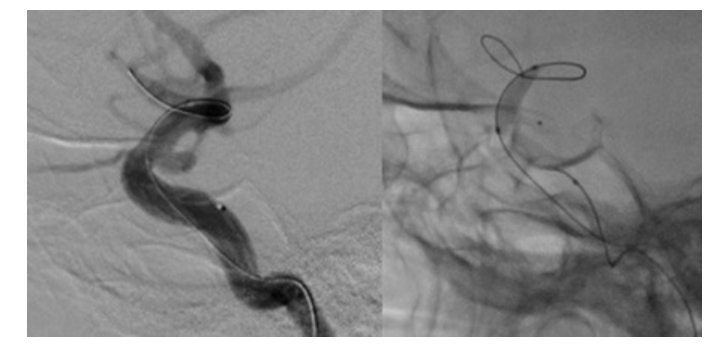 033zrcbpv4y96jhf1ye9mq2eq2nuqiwi.jpg 033zrcbpv4y96jhf1ye9mq2eq2nuqiwi.jpg