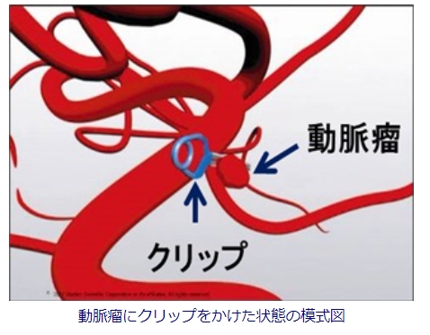 32qq1g-_ssttlqh9w1ful4fzmjxqlgu8.jpg 32qq1g-_ssttlqh9w1ful4fzmjxqlgu8.jpg