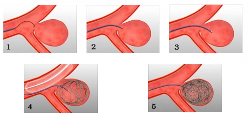 4yncvf2a6ty87b4rwa3__5in9rb4ongz.jpg 4yncvf2a6ty87b4rwa3__5in9rb4ongz.jpg