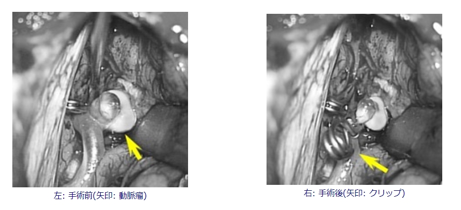 bh_bgc0mlvdayy8yiv2q3w3g3ka4hivg.jpg bh_bgc0mlvdayy8yiv2q3w3g3ka4hivg.jpg