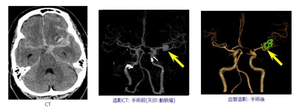 ju0fgxa0r3xqm12ww140gk0exfpv75yq.jpg ju0fgxa0r3xqm12ww140gk0exfpv75yq.jpg