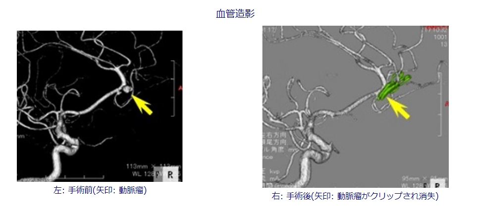 ob8gr29c3zvewasa52_jm4rg38die6cu.jpg ob8gr29c3zvewasa52_jm4rg38die6cu.jpg