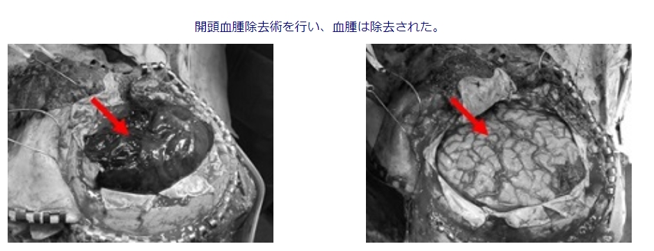 acabxv9x45k6din_lwgoj41g1681z2_e.jpg acabxv9x45k6din_lwgoj41g1681z2_e.jpg