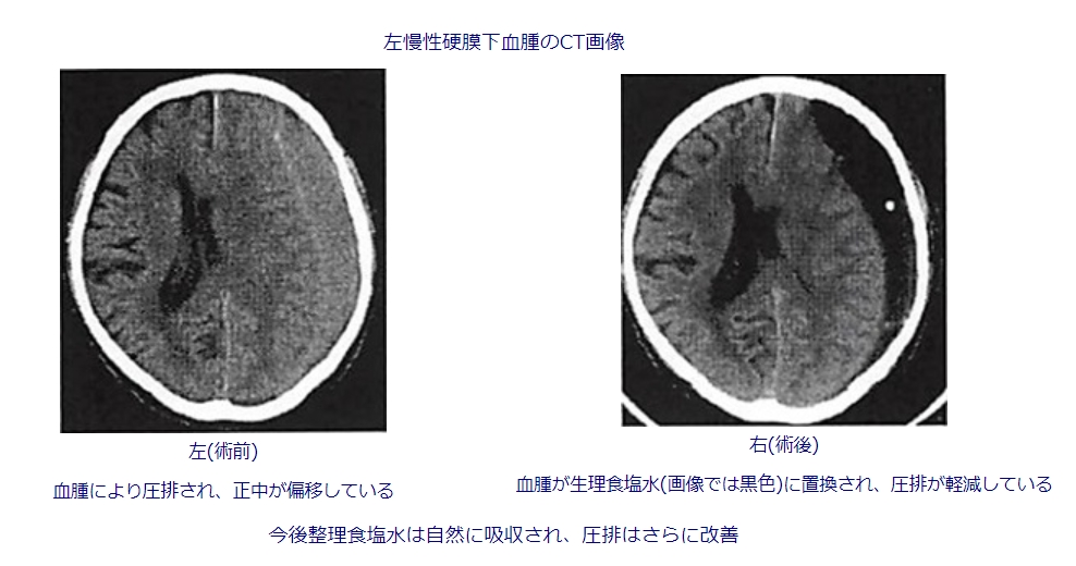 ne_ox35k3xn96r2lyd51xmyf4ssbufbh.jpg ne_ox35k3xn96r2lyd51xmyf4ssbufbh.jpg