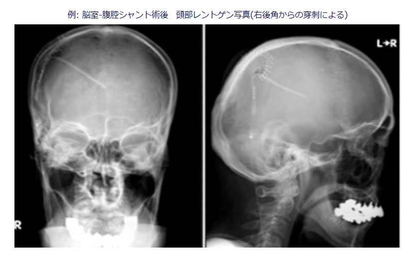 7l0372lzvxvsru4ls---ga-_fzzdz4lt.jpg 7l0372lzvxvsru4ls---ga-_fzzdz4lt.jpg