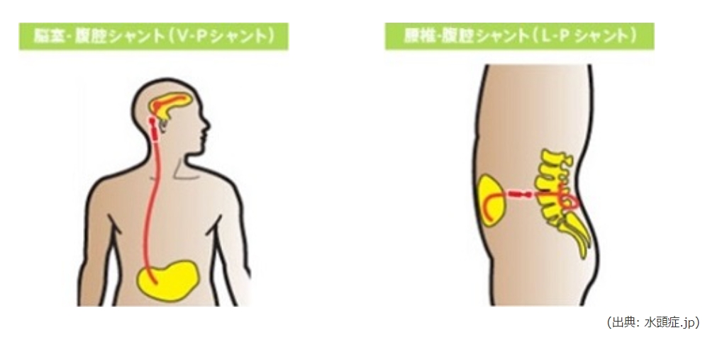 ue2frrkft-sm_ayf-_sl49tr31u_tezs.jpg ue2frrkft-sm_ayf-_sl49tr31u_tezs.jpg