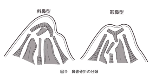dqjk9opht7ebmd2_pojf1mt16f9894qp.jpg dqjk9opht7ebmd2_pojf1mt16f9894qp.jpg