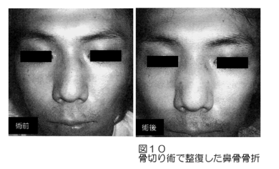 ix89urkl2hk4cqoc1qz0mx-fjzap_8xd.jpg ix89urkl2hk4cqoc1qz0mx-fjzap_8xd.jpg