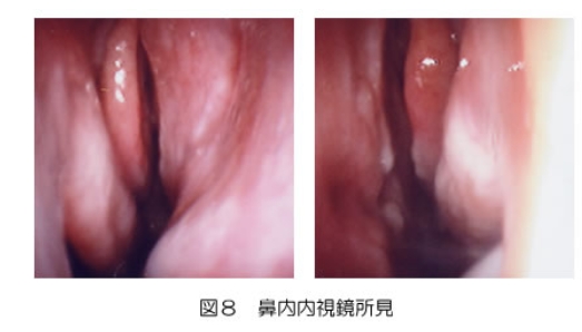 yy_y88saxbwbpef1ntxcjoczrgm0abn6.jpg yy_y88saxbwbpef1ntxcjoczrgm0abn6.jpg